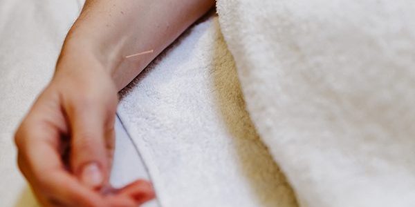 stress en burn-out behandelen met acupunctuur